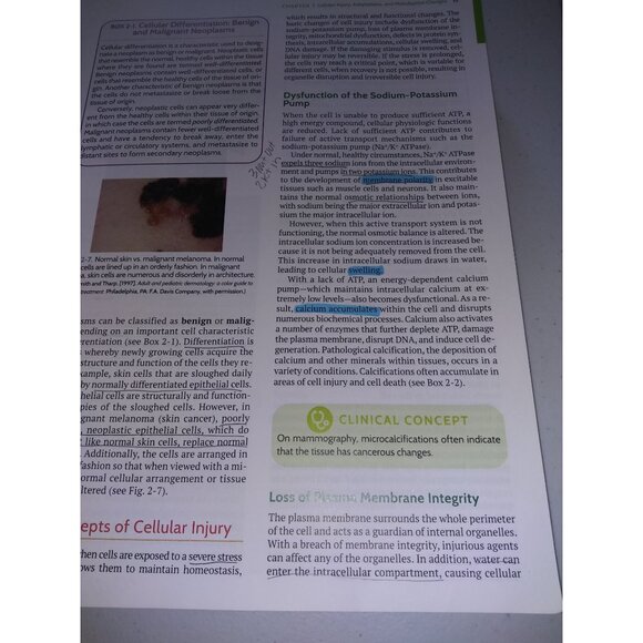 Pathophysiology Introductory Concepts and Clinical Perspectives Book Davis Advan - Picture 11 of 14